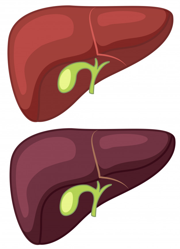 Gallbladder Disease